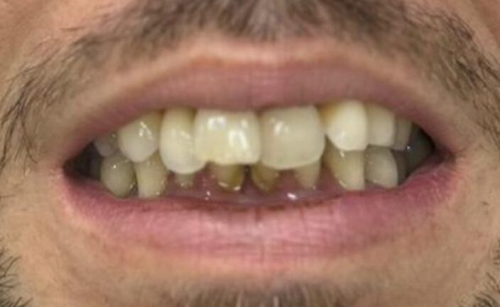 Antes e Depois Dra Cláudia Albaneze