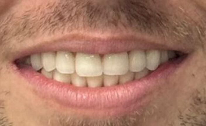 Antes e Depois Dra Cláudia Albaneze 2