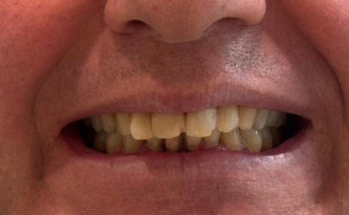 Antes e Depois Dra Cláudia Albaneze 3