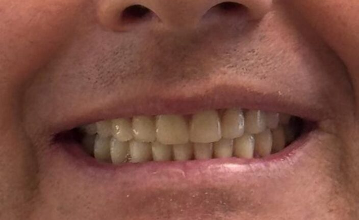 Antes e Depois Dra Cláudia Albaneze 4